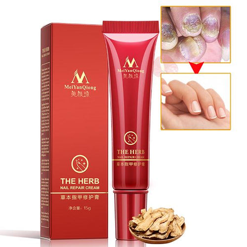 BearPaw Hot Sale Women Man Nail Repair Cream Nail Foot Growth Protector Skin Care Cream Nail Fungus Treatment Herb Health Cream